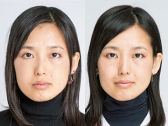 30代 Before/After