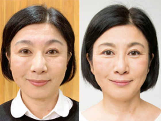 50代〜60代 Before/After