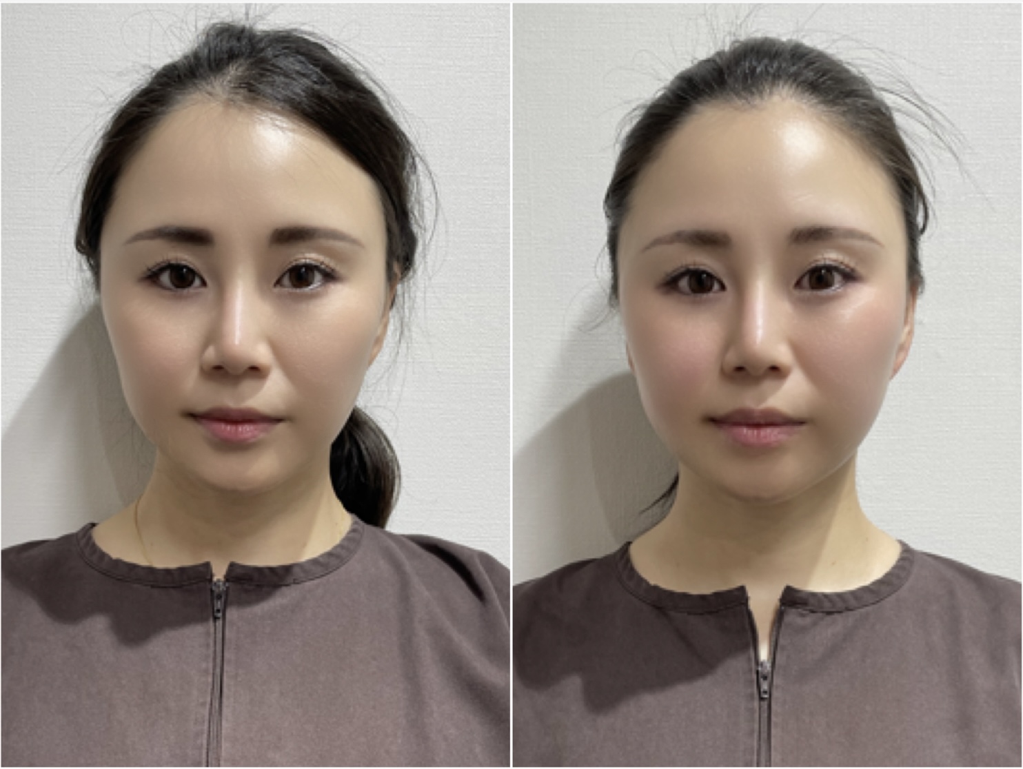 Before/After