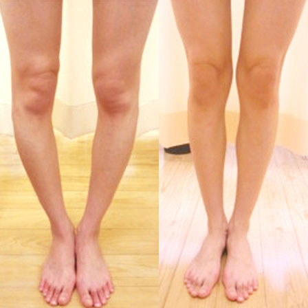Before/After
