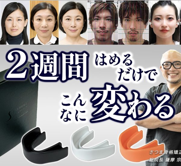 LP-top-01