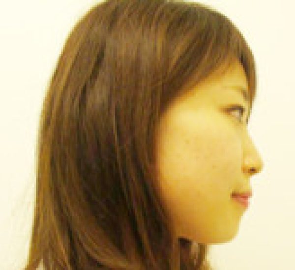 mk