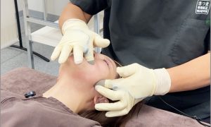 neurolift neurolift