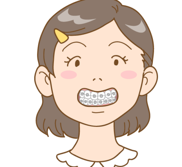 orthodontics_bracket