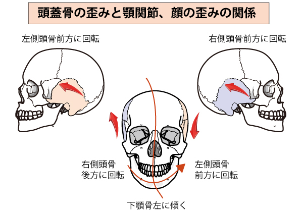 全身頭蓋矯正について | 矯正について | さつま骨格矯正アカデミー